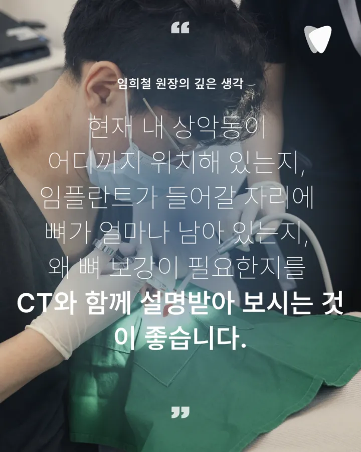 이미지 카드 · 상악동 거상술, 위 어금니 임플란트에서 필요한 경우
