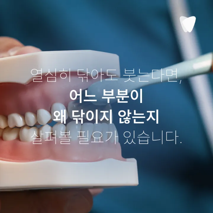 이미지 카드 · 임플란트 주위 잇몸이 붓고 피가 날 때: 점막염·주위염 구분, 연락 시점, 검사와 관리