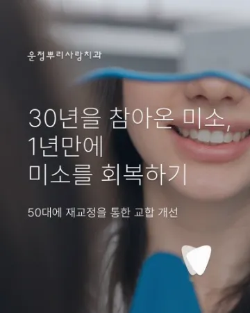 30년을 참아온 미소, 1년 만에 회복하기