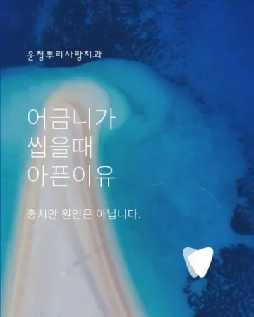 어금니가 씹을 때 아픈 이유, 충치만 원인은 아닙니다