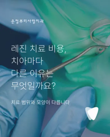 레진 치료 비용이 치아마다 다른 이유: 치료 면·위치·접착 조건