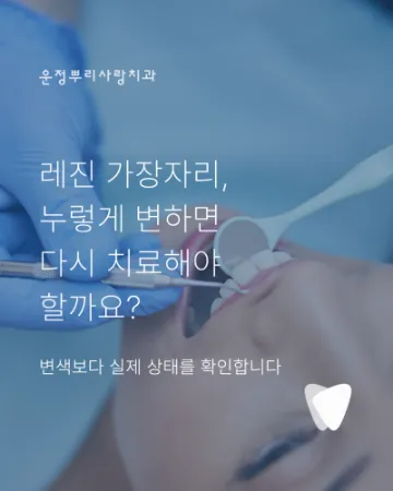 레진 가장자리 변색, 재치료가 필요한 경우와 판단 기준